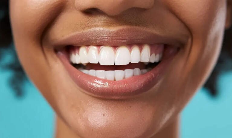 Top Myths About Dental Implants Debunked