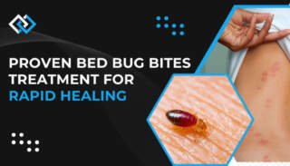 Proven Bed Bug Bite Treatment for Rapid Healing