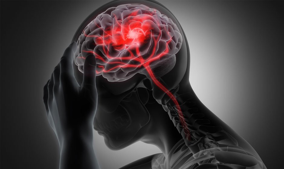 The Impact of Traumatic Brain Injury on Short-Term Memory Recall