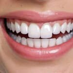 Top Reasons to Choose Professional Cosmetic Whitening Treatments Over DIY