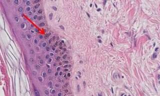 A Beginner’s Guide to Preparing H&E Staining in Simple Steps