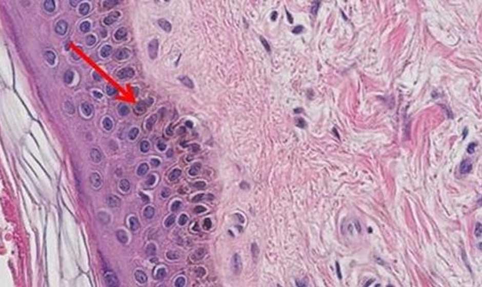 A Beginner’s Guide to Preparing H&E Staining in Simple Steps