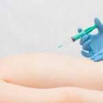 The Guide to a Trigger Point Injection Procedure for Pain Management