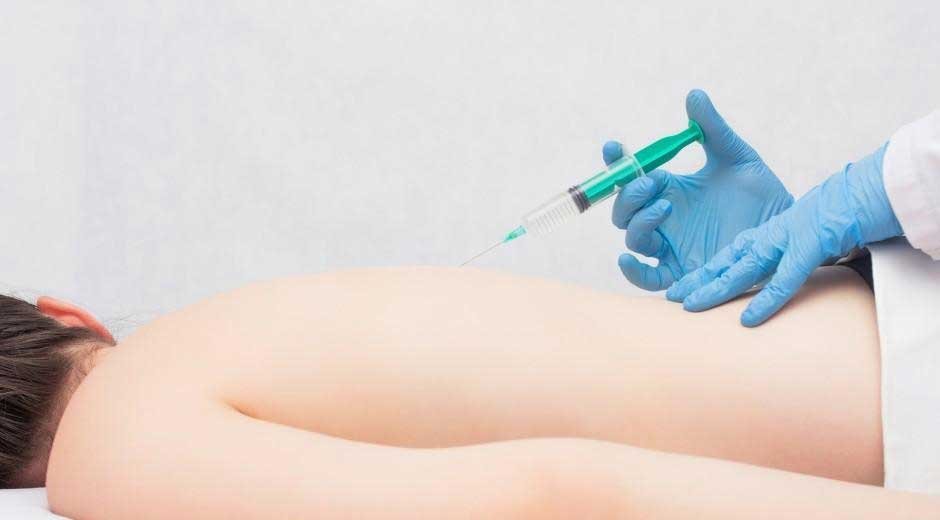 The Guide to a Trigger Point Injection Procedure for Pain Management