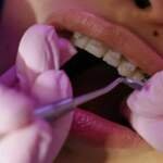 Understanding the Benefits of Braces for a Healthier Smile