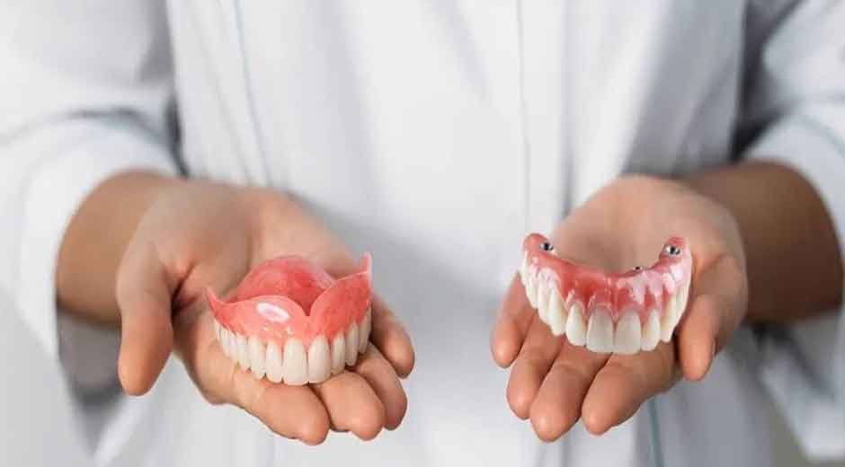 Benefits of Choosing Implant Dentures for a Secure Fit