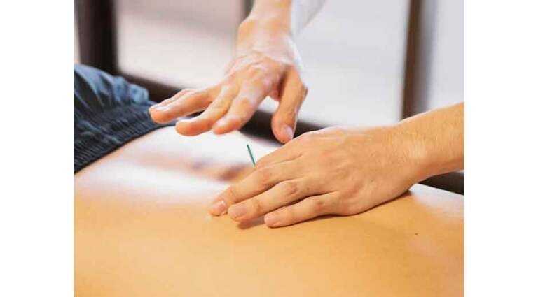 Dry-Needling-Benefits-Explained-Through-Scientific-Research