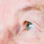 How Aging Eyes Affect Diabetic Retinopathy in Seniors