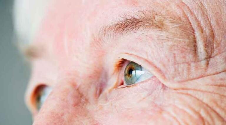 How-Aging-Eyes-Affect-Diabetic-Retinopathy-in-Seniors