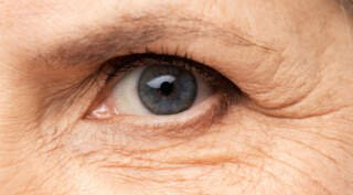 Signs of Accelerated Cataract Progression in Aging Eyes